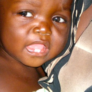 Baby who is HIV positive